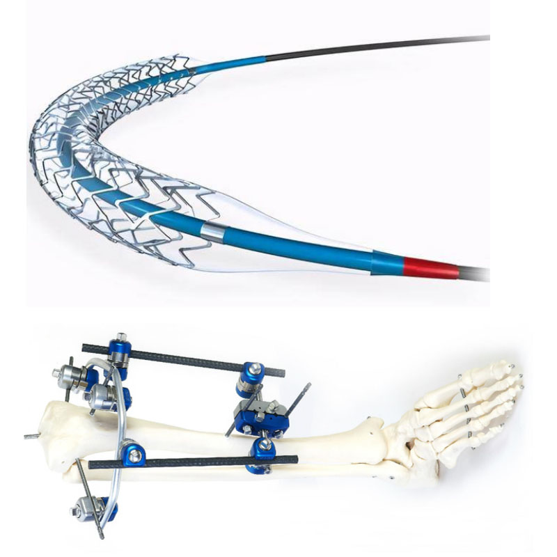 Moldagem por stent médico